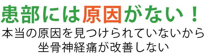 坐骨神経痛